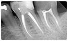 Endodontic Courses